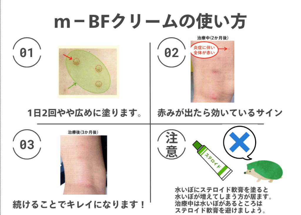 M-BFクリームの使い方。1日2回やや広めに塗る、赤みが出たら効いているサイン、続けることできれいになる、水いぼにステロイド軟膏を塗らない