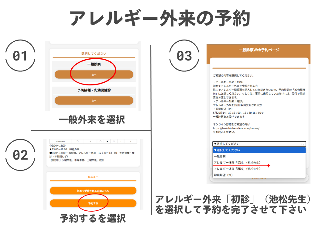 アレルギー外来予約方法