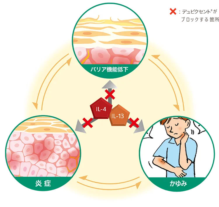 デュピクセント皮下注製剤