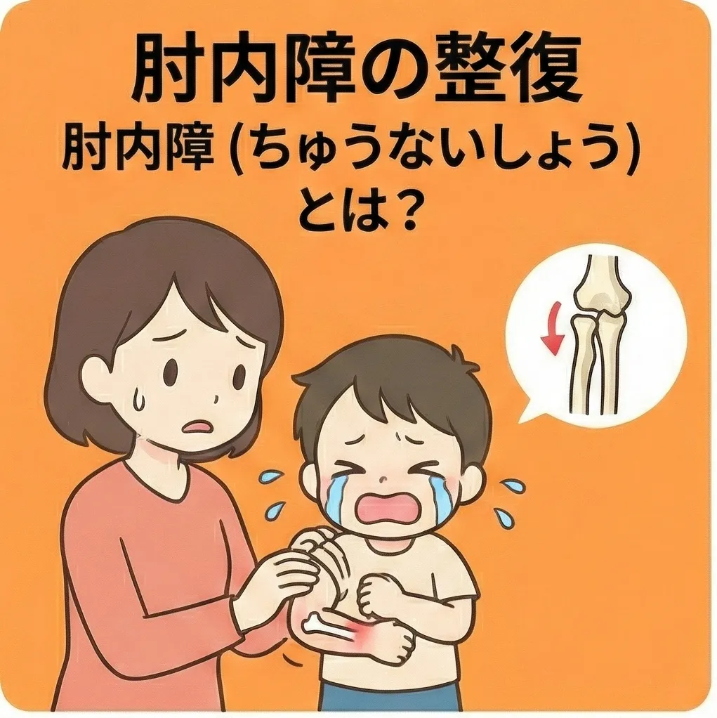 肘内障の仕組みイラスト