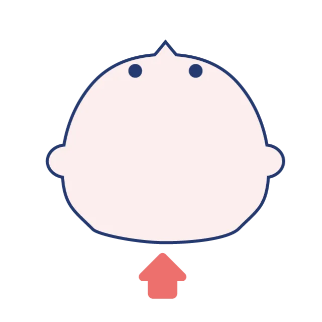 短頭症の頭の形の図解