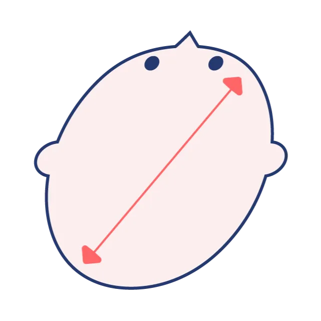 斜頭症の頭の形の図解