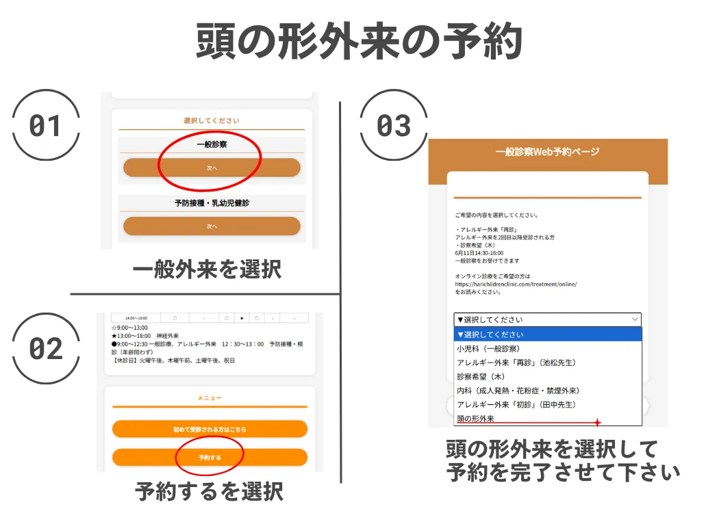 頭の形外来の予約手順